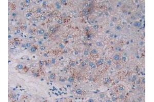 Figure. (TPSAB1 anticorps  (AA 161-262))