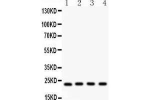 Western blot analysis of BAK using anti-BAK antibody .