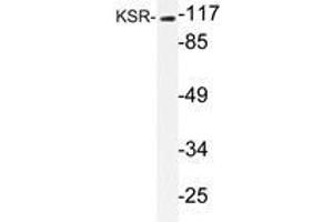Western blot analysis of KSR antibody in extracts from NIH/3T3 cells. (KSR1 anticorps)