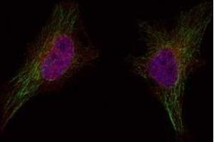 Image no. 1 for anti-Breast Cancer 1 (BRCA1) (Ser1524) antibody (ABIN401620) (BRCA1 anticorps  (Ser1524))