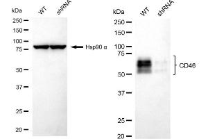 Western blotting analysis using CD46 antibody (ABIN7797974). (Recombinant CD46 anticorps)