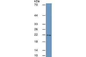 Mouse Capture antibody from the kit in WB with Positive Control: human liver lysate.