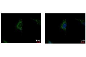 ICC/IF Image SDHA antibody detects SDHA protein at mitochondria by immunofluorescent analysis.