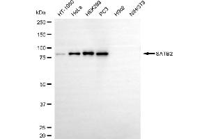 Western blotting analysis using SATB2 antibody (ABIN7800274).