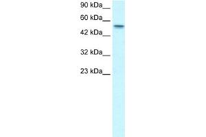 WB Suggested Anti-RUNX1T1 Antibody Titration:  1. (RUNX1T1 anticorps  (Middle Region))
