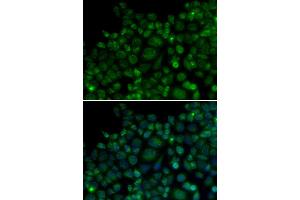 Immunofluorescence analysis of MCF7 cell using TLR7 antibody.