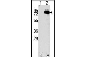 Western blot analysis of NUAK2 (arrow) using rabbit polyclonal NUAK2 Antibody (N-term) (R). (NUAK2 anticorps  (N-Term))