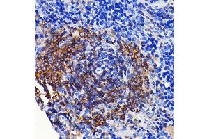 Immunohistochemistry of paraffin-embedded rat spleen using SHP1 Rabbit mAb (ABIN7269716) at dilution of 1:100 (40x lens). (SHP1 anticorps)
