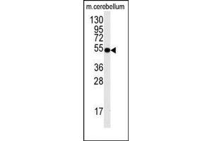 Image no. 1 for anti-Cell Division Cycle 25 Homolog A (S. Pombe) (CDC25A) (Ser78) antibody (ABIN358772) (CDC25A anticorps  (Ser78))
