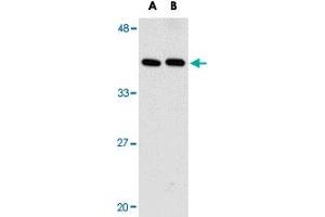 Western blot analysis of PTER in human kidney tissue lysate with PTER polyclonal antibody  at (A) 1 and (B) 2 ug/mL . (PTER anticorps  (C-Term))