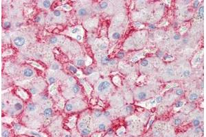 Human Liver (formalin-fixed, paraffin-embedded) stained with SLC2A2 antibody ABIN337148 at 10 ug/ml followed by biotinylated anti-mouse IgG secondary antibody ABIN481714, alkaline phosphatase-streptavidin and chromogen. (SLC2A2 anticorps)