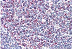 Tonsil, Human: Formalin-Fixed, Paraffin-Embedded (FFPE) (PGLS anticorps  (C-Term))