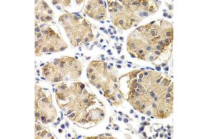 Immunohistochemistry of paraffin-embedded human normal stomach using CHIT1 antibody at dilution of 1:200 (400x lens). (Chitotriosidase 1 anticorps)
