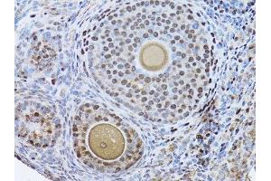 Immunohistochemistry of paraffin-embedded mouse ovary using PCNA antibody. (PCNA anticorps  (AA 1-261))