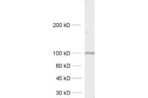 dilution: 1 : 1000, sample: synaptic membrane fraction of rat brain (LP1) (GRIA4 anticorps  (AA 850-902))