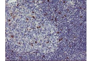 Image no. 2 for anti-RNA Binding Protein with Multiple Splicing (RBPMS) antibody (ABIN1500642)