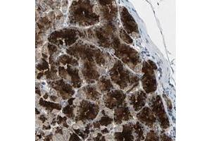 Immunohistochemical staining of human stomach with CDCA7 polyclonal antibody  shows strong cytoplasmic positivity in granular pattern in glandular cells at 1:200-1:500 dilution. (CDCA7 anticorps)