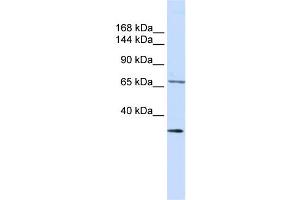 WB Suggested Anti-SEMA6D Antibody Titration:  0.