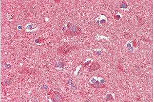 anti-Carnitine O-Octanoyltransferase (CROT) (C-Term) antibody