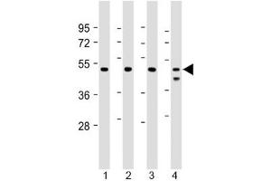 Western blot testing of human 1) Jurkat, 2) U-2 0S, 3) HeLa and 4) MCF7 cell lysate with PSMC2 antibody at 1:2000.