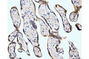 IHC analysis of Neurofibromin/NF1 using anti-Neurofibromin/NF1 antibody (ABIN7600196).