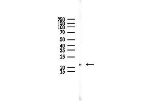 anti-RAB6A, Member RAS Oncogene Family (RAB6A) (Internal Region) antibody