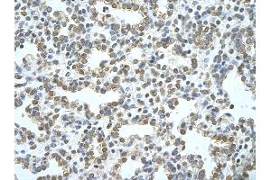 Rabbit Anti-ATG4B Antibody       Paraffin Embedded Tissue:  Human alveolar cell   Cellular Data:  Epithelial cells of renal tubule  Antibody Concentration:   4.