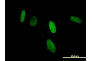 Immunofluorescence of purified MaxPab antibody to ZNF266 on HeLa cell. (ZNF266 anticorps  (AA 1-263))