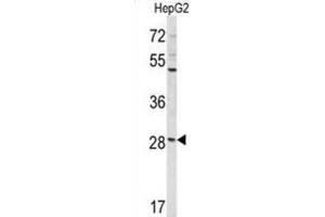 Western Blotting (WB) image for anti-Coiled-Coil Domain Containing 85B (CCDC85B) antibody (ABIN3004037) (CCDC85B anticorps)