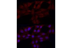 Immunofluorescence analysis of PC-12 cells using GRP Rabbit pAb (ABIN6127573, ABIN6141433, ABIN6141434 and ABIN6222002) at dilution of 1:50 (40x lens).