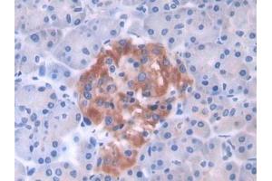 Detection of GLTP in Human Pancreas Tissue using Polyclonal Antibody to Glycolipid Transfer Protein (GLTP)