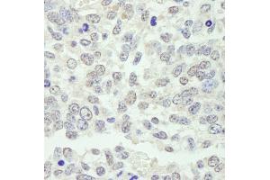 Immunohistochemistry (IHC) image for anti-Karyopherin alpha 3 (Importin alpha 4) (KPNA3) (AA 1-50) antibody (ABIN7448982)