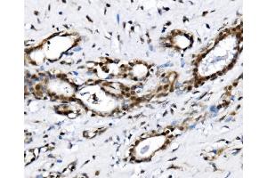 IHC analysis of NOLA1/GAR1 using anti-NOLA1/GAR1 antibody (ABIN7602076). (GAR1 anticorps  (AA 58-165))