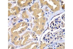 Immunohistochemistry of paraffin-embedded Human kidney using WIPI2 Polyclonal Antibody at dilution of 1:100 (40x lens). (WIPI2 anticorps)