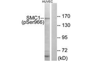 Western blot analysis of extracts from HuvEc cells treated with etoposide 24uM 24h, using SMC1 (Phospho-Ser966) Antibody. (SMC1A anticorps  (pSer966))