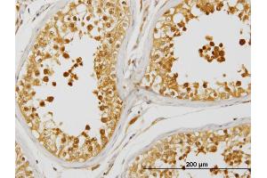 Immunoperoxidase of monoclonal antibody to PRDX4 on formalin-fixed paraffin-embedded human testis.