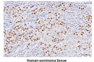 Immunohistochemistry (IHC) image for anti-Nanog Homeobox (NANOG) (AA 1-154), (N-Term) antibody (ABIN317542) (Nanog anticorps  (N-Term))