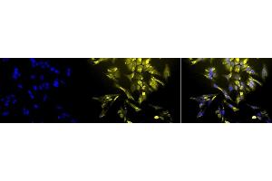 Immunocytochemistry/Immunofluorescence analysis using Mouse Anti-HO-1 Monoclonal Antibody, Clone 1F12-A6 (ABIN361696 and ABIN361697).