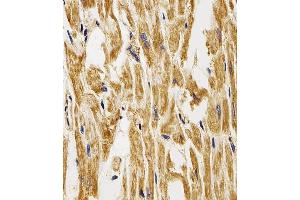 Immunohistochemical analysis of paraffin-embedded H. (FABP3 anticorps  (AA 1-133))