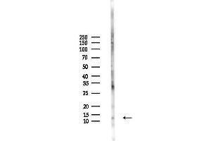 anti-Transmembrane Protein 93 (TMEM93) antibody