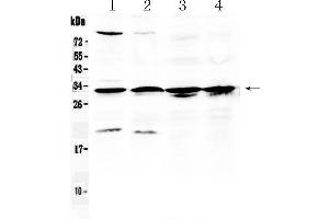 Western blot analysis of RPS6 using anti- RPS6 antibody .
