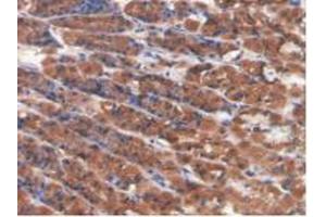 Figure. (CAMK2A anticorps  (AA 1-478))