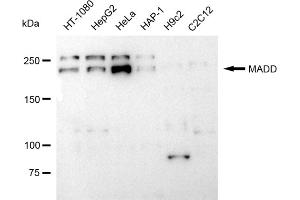 Western blotting analysis using MADD antibody (ABIN7799332). (Recombinant MADD anticorps)