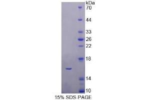 SDS-PAGE analysis of Human CBY1 Protein. (CBY1/PGEA1 Protéine)