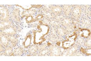 Detection of HTRA1 in Human Kidney Tissue using Polyclonal Antibody to High Temperature Requirement Factor A1 (HTRA1)
