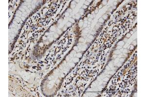 Immunoperoxidase of monoclonal antibody to FAM3B on formalin-fixed paraffin-embedded human small Intestine. (FAM3B anticorps  (AA 1-235))