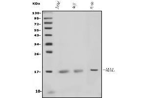 Western blot analysis of MAL using anti-MAL antibody (ABIN7602807).