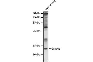 Western blot analysis of extracts of Rat kidney, using GNRH1 antibody (ABIN6131875, ABIN6141257, ABIN6141258 and ABIN6221260) at 1:1000 dilution. (GNRH1 anticorps  (AA 24-92))