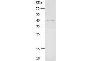 Western Blotting (WB) image for LIM and Cysteine-Rich Domains 1 (LMCD1) (AA 1-365) protein (His tag) (ABIN7123761)