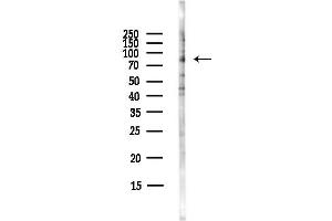 anti-Holliday Junction Recognition Protein (HJURP) (C-Term) antibody